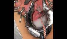 Extreme Cervix Sounding