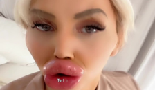 World Biggest Fake Lips + Close Ups | Vienna Wuerstel
