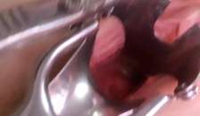 Shows the Uterus in Close-up through a Speculum